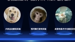 脑机接口技术迎突破发展期 新质生产力驱动产业升级